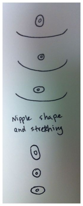 FTM Top Surgery Nipples